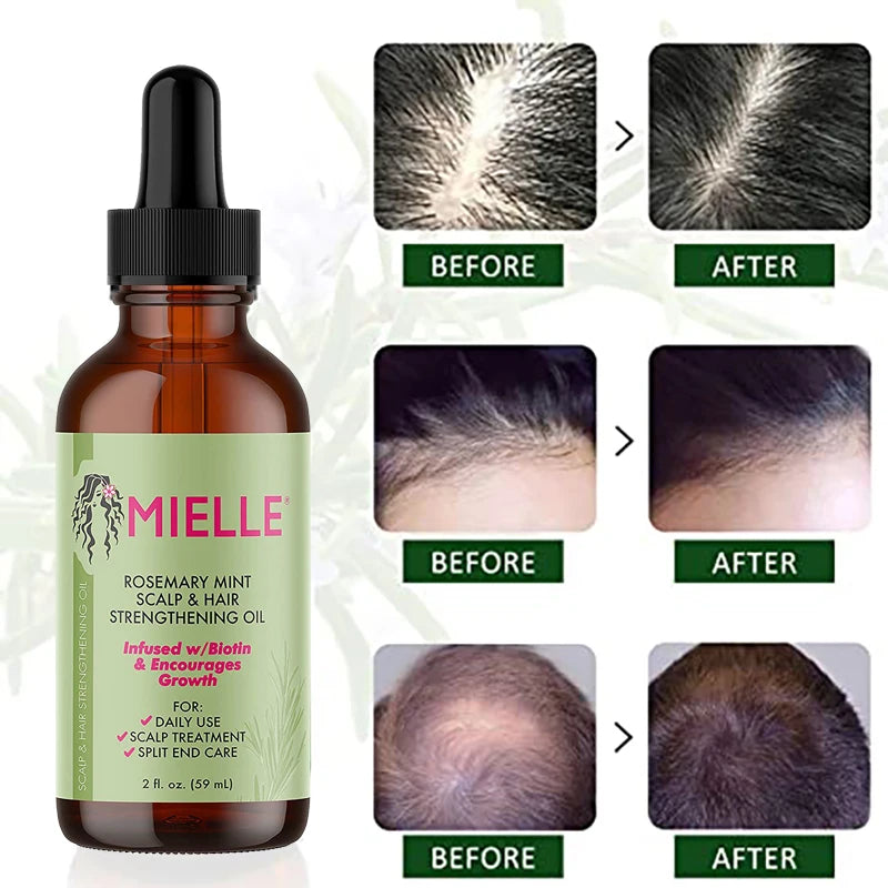 Hair Growth Mint Essential Oil Rosemary Hair Strengthening Oil Nourishing Treatment For Split Ends And Dry Mielle Organics Hair